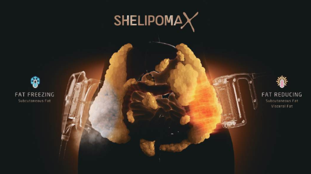 SHELIPOMAX NEW_CYCLONE S CYCLONE X_1